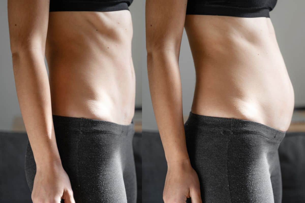 How long does diastasis recti take to improve Hammersmith and Fulham?