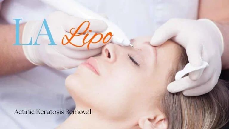 Woman receiving Actinic Keratosis Removal Treatment Hammersmith and Fulham