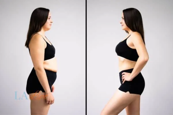 link between body image and mental health Hammersmith and Fulham