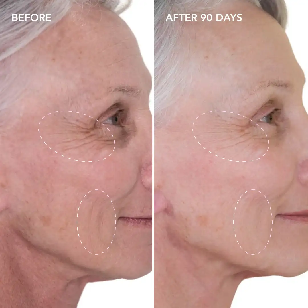 When will you see results Hammersmith and Fulham